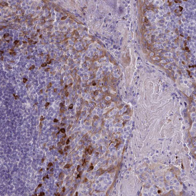Desmocollin 3 Antibody in Immunohistochemistry (Paraffin) (IHC (P))