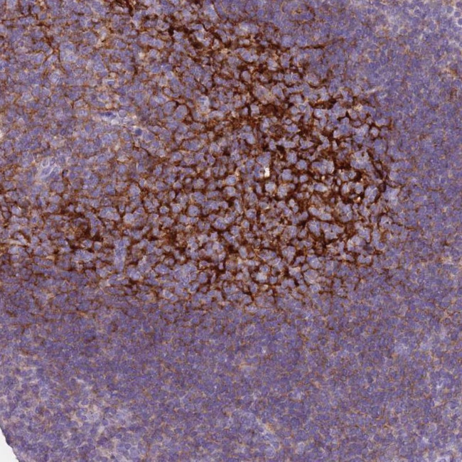 CD35 Antibody in Immunohistochemistry (Paraffin) (IHC (P))