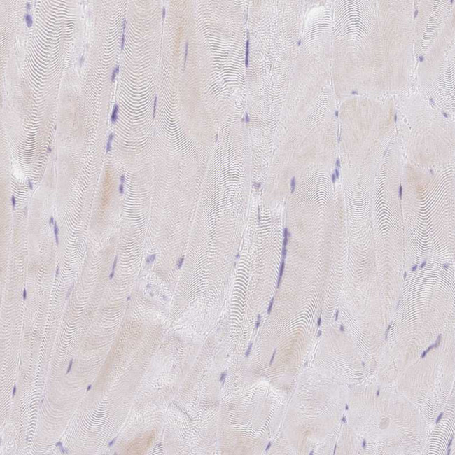 AL592183.1 Antibody in Immunohistochemistry (Paraffin) (IHC (P))