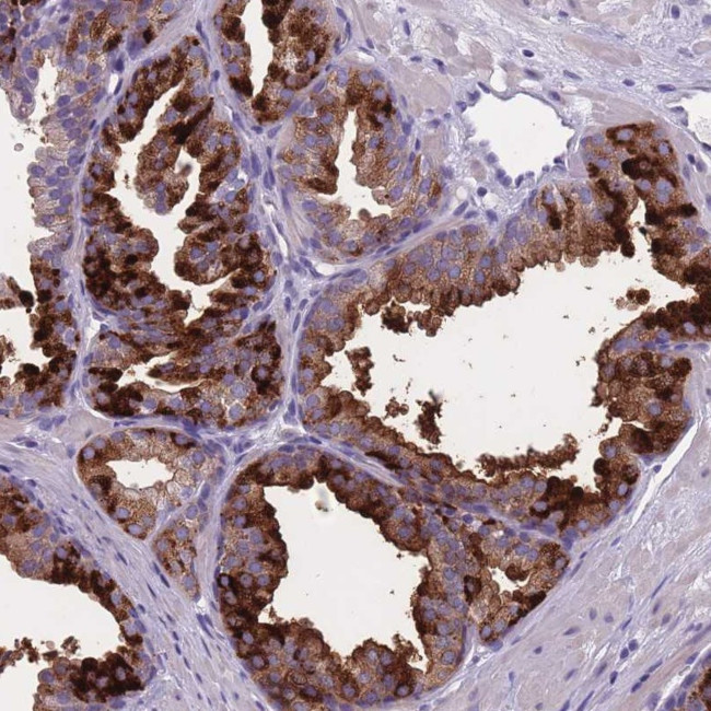 OR4C5 Antibody in Immunohistochemistry (Paraffin) (IHC (P))