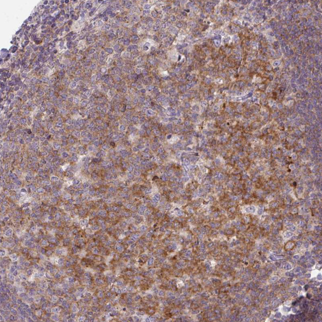 CD80 Antibody in Immunohistochemistry (Paraffin) (IHC (P))