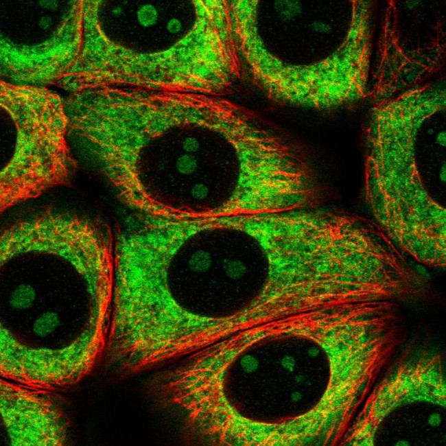 RPL8 Antibody in Immunocytochemistry (ICC/IF)