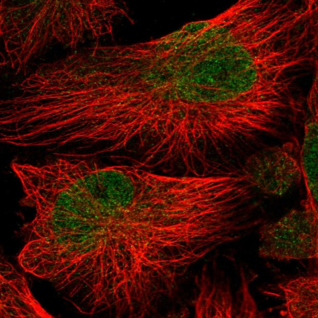 ATG16L2 Antibody in Immunocytochemistry (ICC/IF)