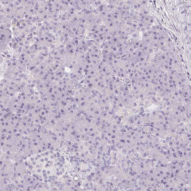 CD69 Antibody in Immunohistochemistry (Paraffin) (IHC (P))