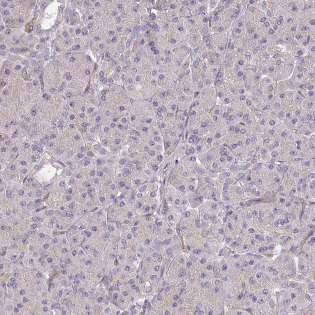 PCDH1 Antibody in Immunohistochemistry (Paraffin) (IHC (P))