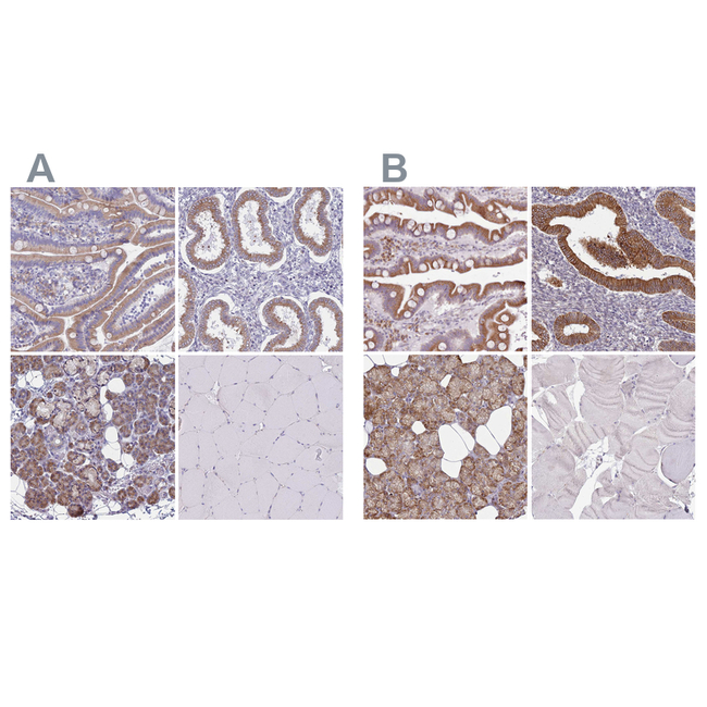 TMP21 Antibody in Immunohistochemistry (Paraffin) (IHC (P))