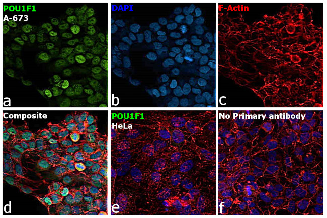 PIT1 Antibody in Immunocytochemistry (ICC/IF)