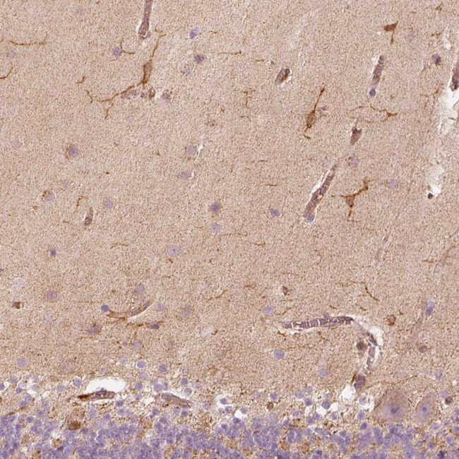 Fascin Antibody in Immunohistochemistry (Paraffin) (IHC (P))