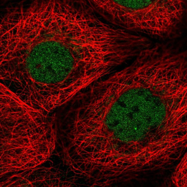 TMEM94 Antibody in Immunocytochemistry (ICC/IF)