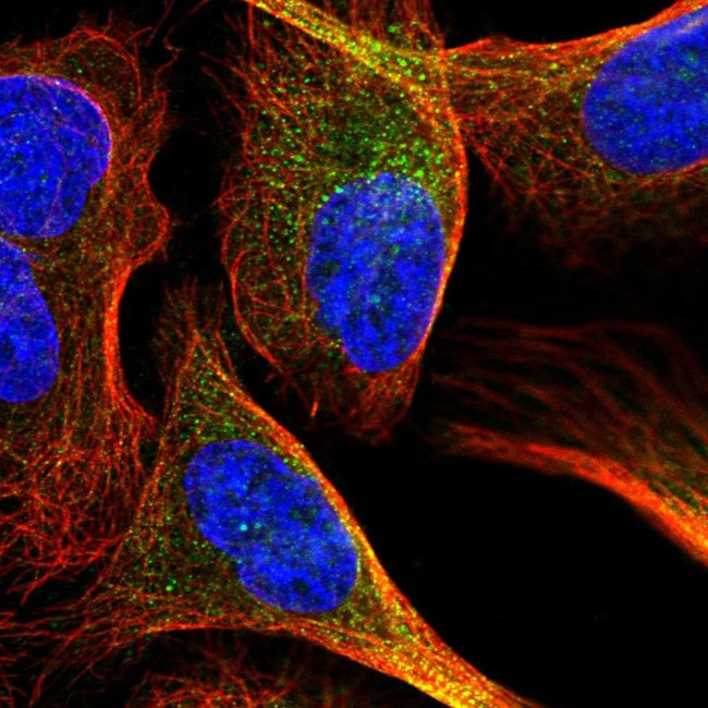 NAA15 Antibody in Immunocytochemistry (ICC/IF)