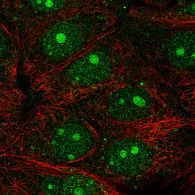 NYREN18 Antibody in Immunocytochemistry (ICC/IF)