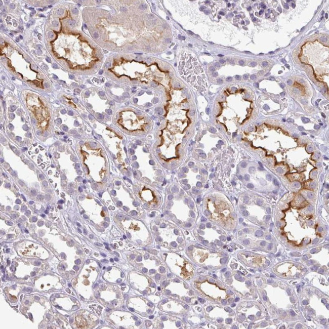 CD229 Antibody in Immunohistochemistry (Paraffin) (IHC (P))