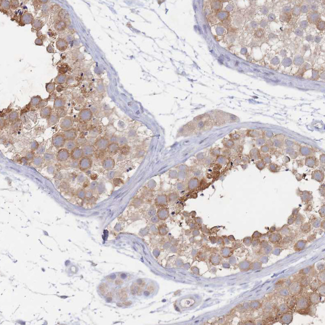 PPP6C Antibody in Immunohistochemistry (Paraffin) (IHC (P))