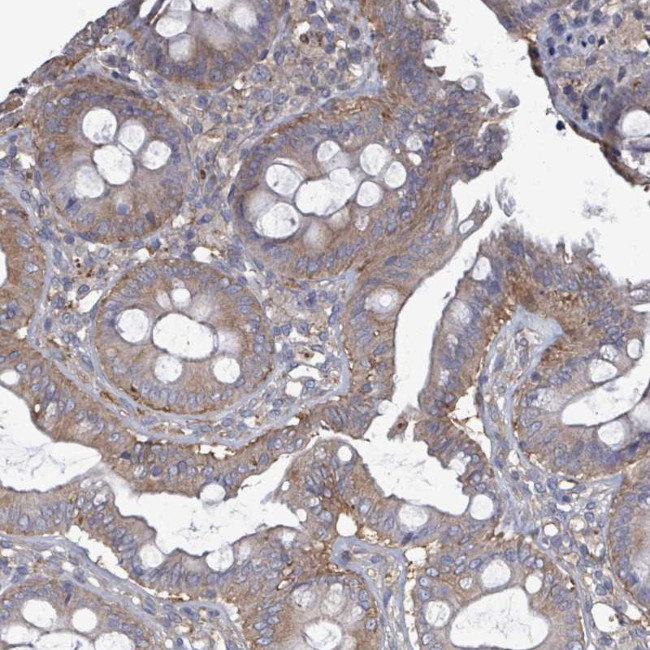 ADCK1 Antibody in Immunohistochemistry (Paraffin) (IHC (P))