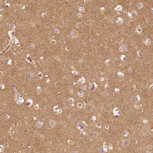 WDR7 Antibody in Immunohistochemistry (Paraffin) (IHC (P))