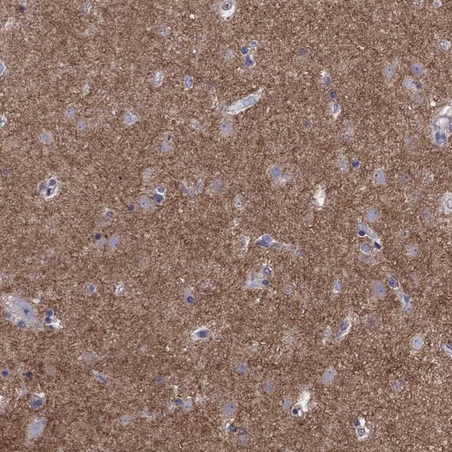 GNAL Antibody in Immunohistochemistry (Paraffin) (IHC (P))
