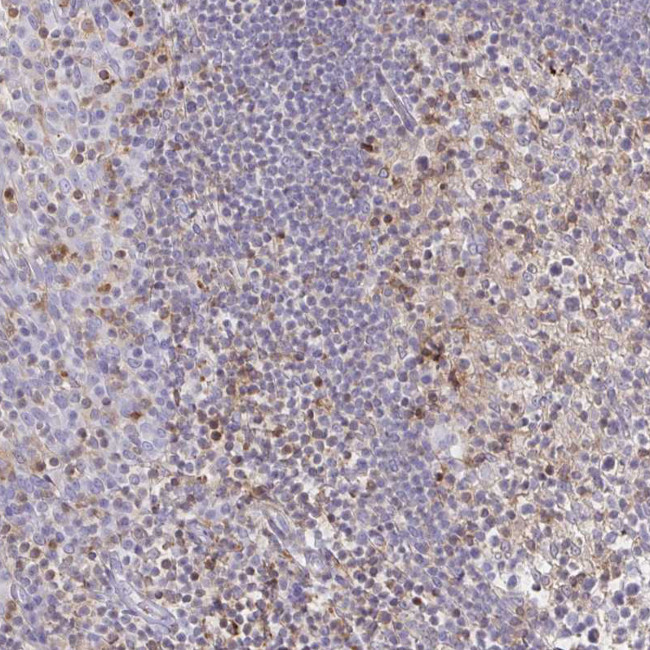 CCL21 Antibody in Immunohistochemistry (Paraffin) (IHC (P))