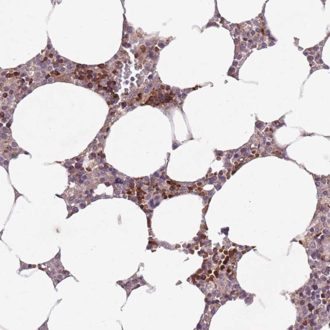 SECTM1 Antibody in Immunohistochemistry (Paraffin) (IHC (P))
