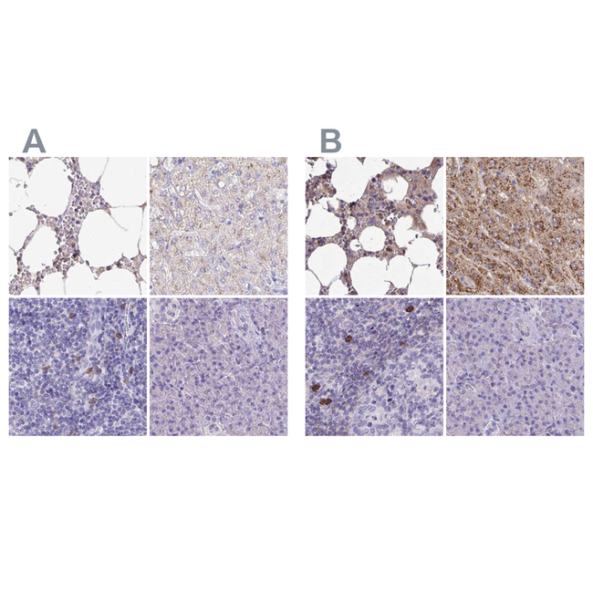 Catalase Antibody in Immunohistochemistry (Paraffin) (IHC (P))