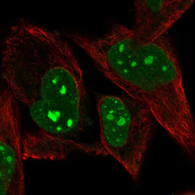 PRDM5 Antibody in Immunocytochemistry (ICC/IF)