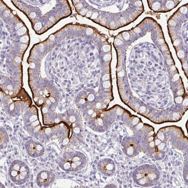 RhoC Antibody in Immunohistochemistry (Paraffin) (IHC (P))