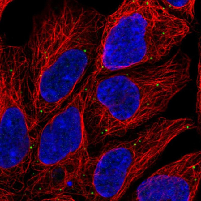 LAMP3 Antibody in Immunocytochemistry (ICC/IF)