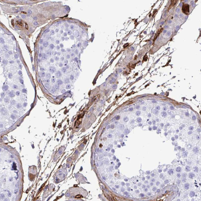 Thrombin Antibody in Immunohistochemistry (Paraffin) (IHC (P))