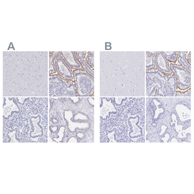SGLT1 Antibody in Immunohistochemistry (Paraffin) (IHC (P))