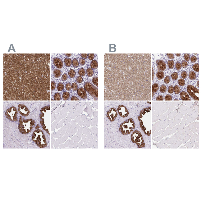 BCAS1 Antibody in Immunohistochemistry (Paraffin) (IHC (P))