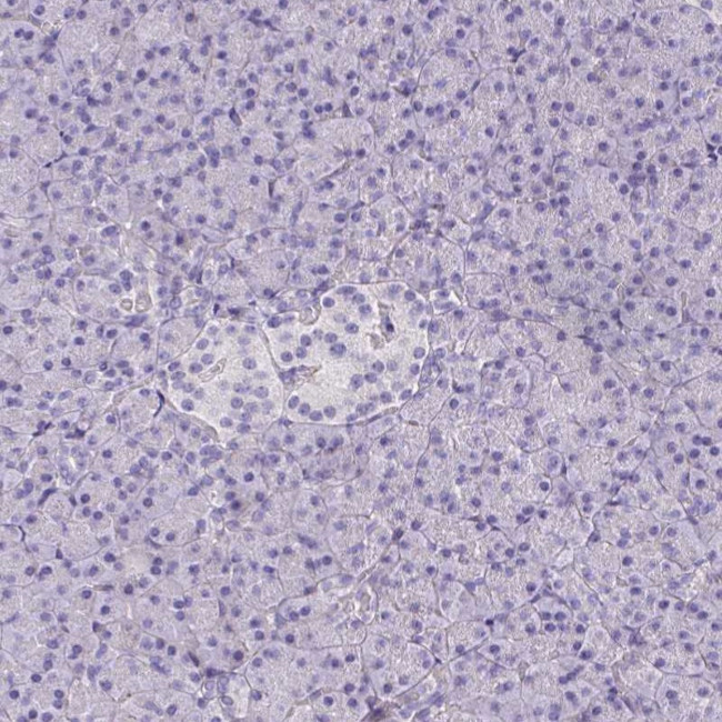 Talin 2 Antibody in Immunohistochemistry (Paraffin) (IHC (P))