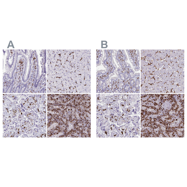 CD163 Antibody in Immunohistochemistry (Paraffin) (IHC (P))