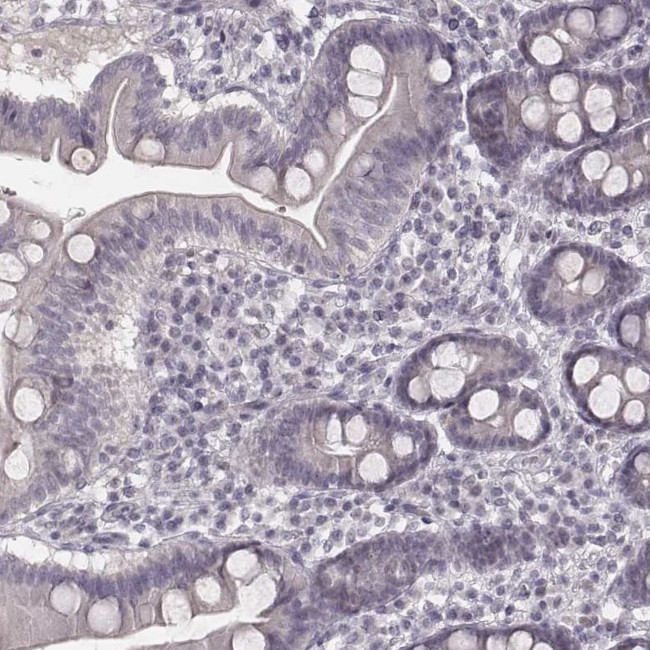 IQCG Antibody in Immunohistochemistry (Paraffin) (IHC (P))