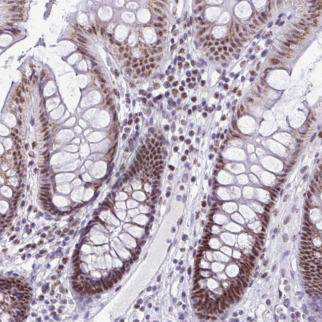 PUF60 Antibody in Immunohistochemistry (Paraffin) (IHC (P))