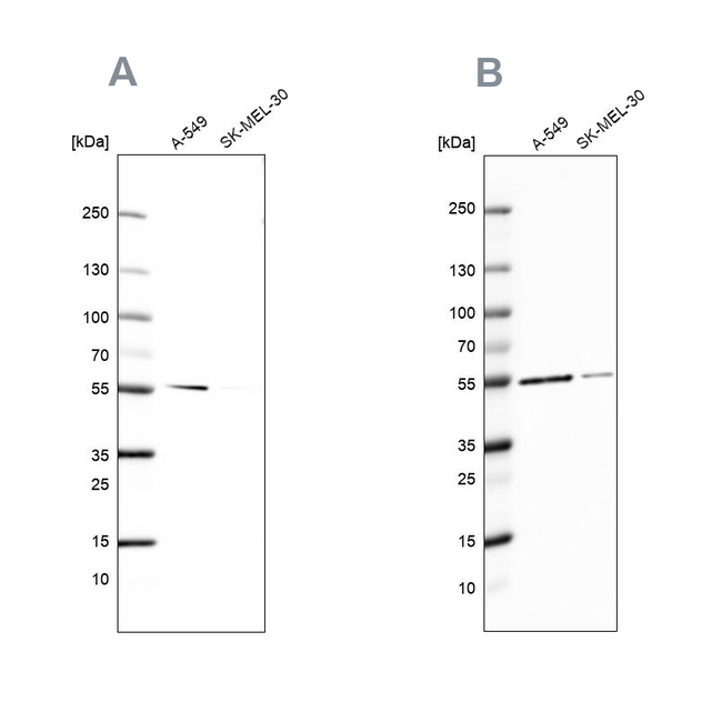 GPI Antibody in Western Blot (WB)