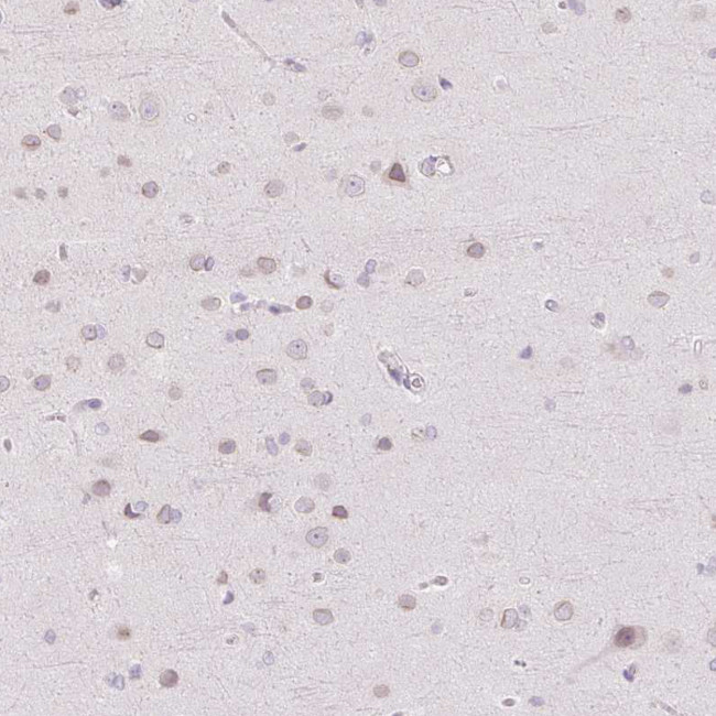 TBX15 Antibody in Immunohistochemistry (Paraffin) (IHC (P))