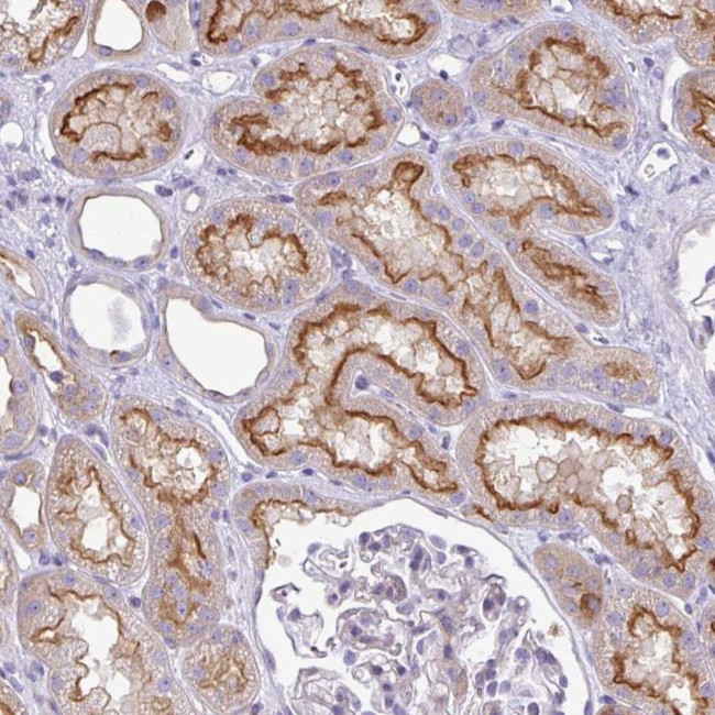 MRP5 Antibody in Immunohistochemistry (Paraffin) (IHC (P))