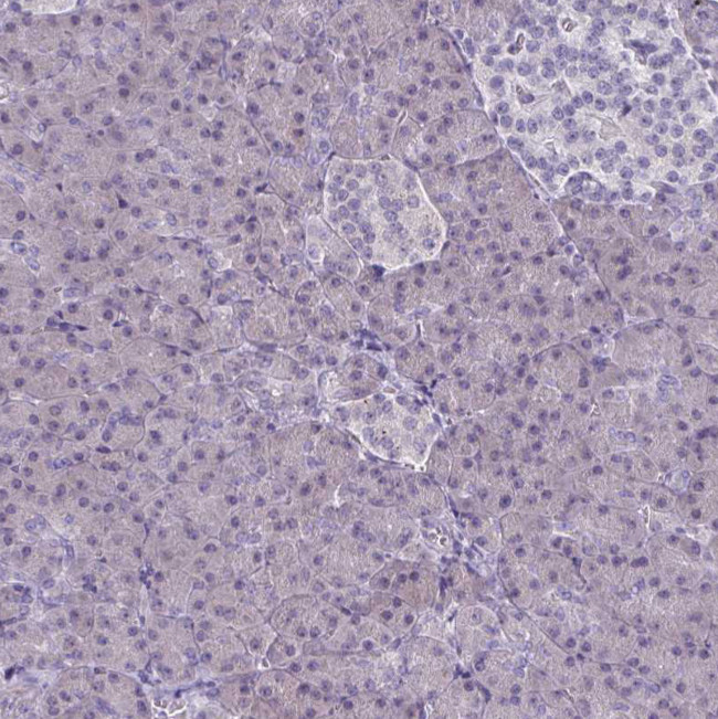 CD38 Antibody in Immunohistochemistry (Paraffin) (IHC (P))