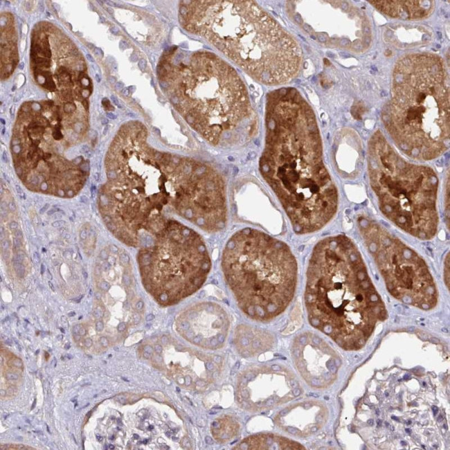 CTDSP2 Antibody in Immunohistochemistry (Paraffin) (IHC (P))