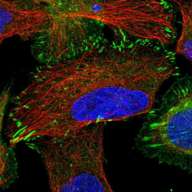 TRIP6 Antibody in Immunocytochemistry (ICC/IF)