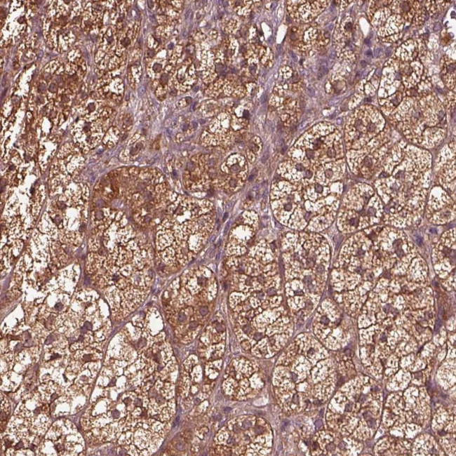 ASCC2 Antibody in Immunohistochemistry (Paraffin) (IHC (P))