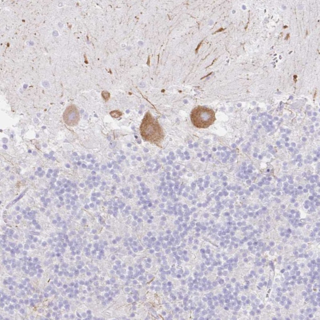 DKK4 Antibody in Immunohistochemistry (Paraffin) (IHC (P))