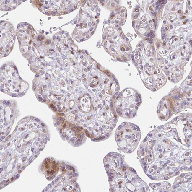 PLA2G5 Antibody in Immunohistochemistry (Paraffin) (IHC (P))
