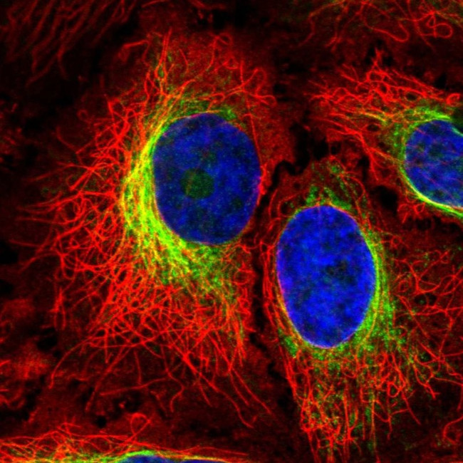 PTPN18 Antibody in Immunocytochemistry (ICC/IF)