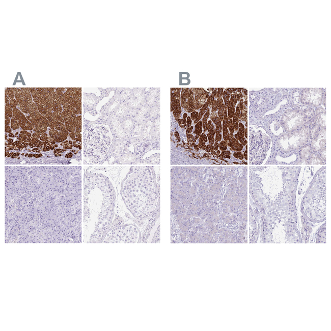 CYP21A2 Antibody in Immunohistochemistry (Paraffin) (IHC (P))