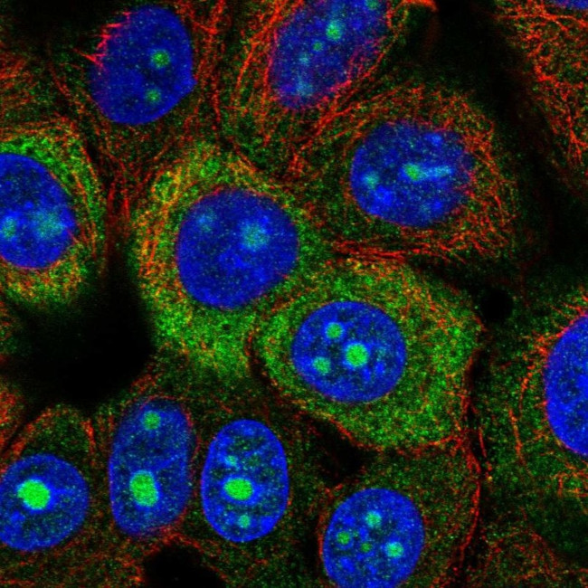 RPS3A Antibody in Immunocytochemistry (ICC/IF)