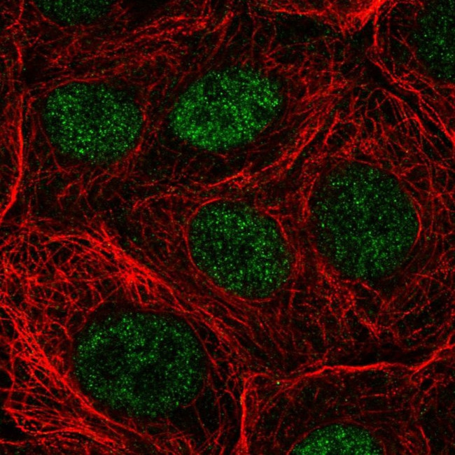 NUDT22 Antibody in Immunocytochemistry (ICC/IF)