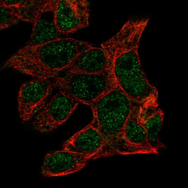 PDIA2 Antibody in Immunocytochemistry (ICC/IF)