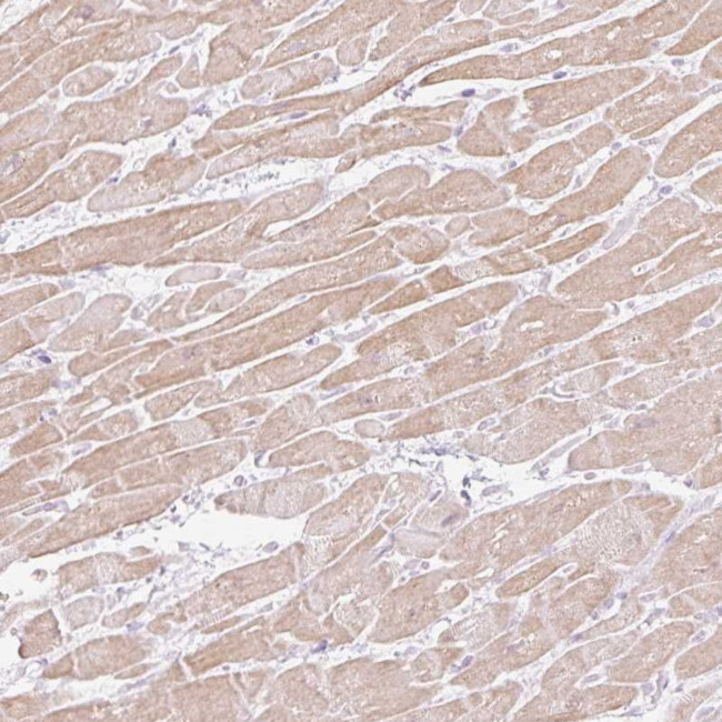 C3orf49 Antibody in Immunohistochemistry (Paraffin) (IHC (P))