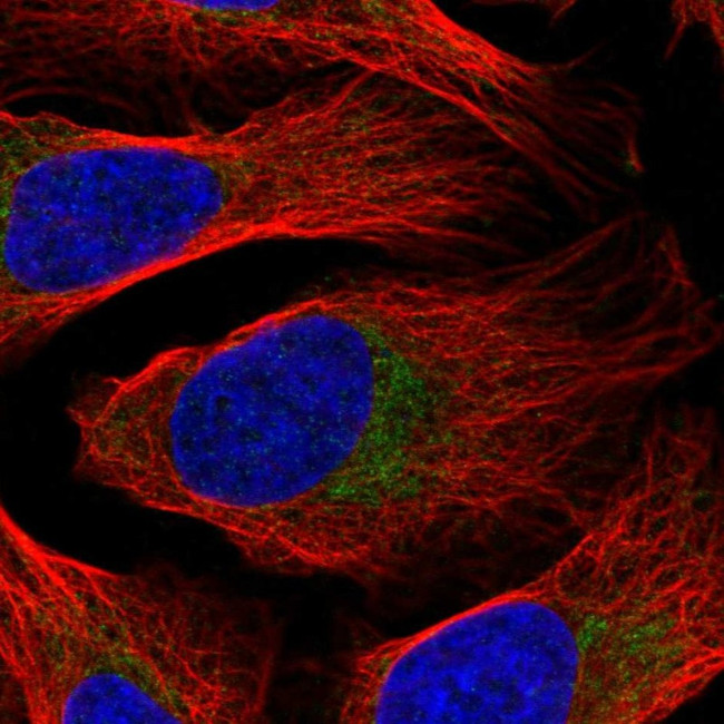 DDX28 Antibody in Immunocytochemistry (ICC/IF)