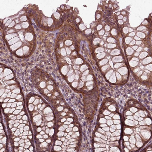 PLCD3 Antibody in Immunohistochemistry (Paraffin) (IHC (P))